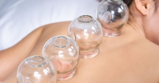 Traditional Acupuncture