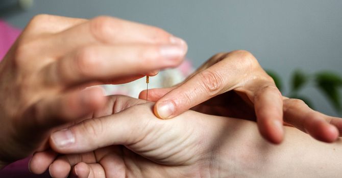 Facial Rejuvenation Acupuncture